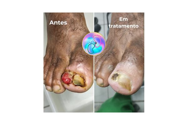 Foto de antes e depois do tratamento 24